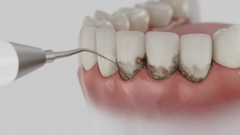 Reliable Dental contractor in Affton, MO by Smile Center Dentistry